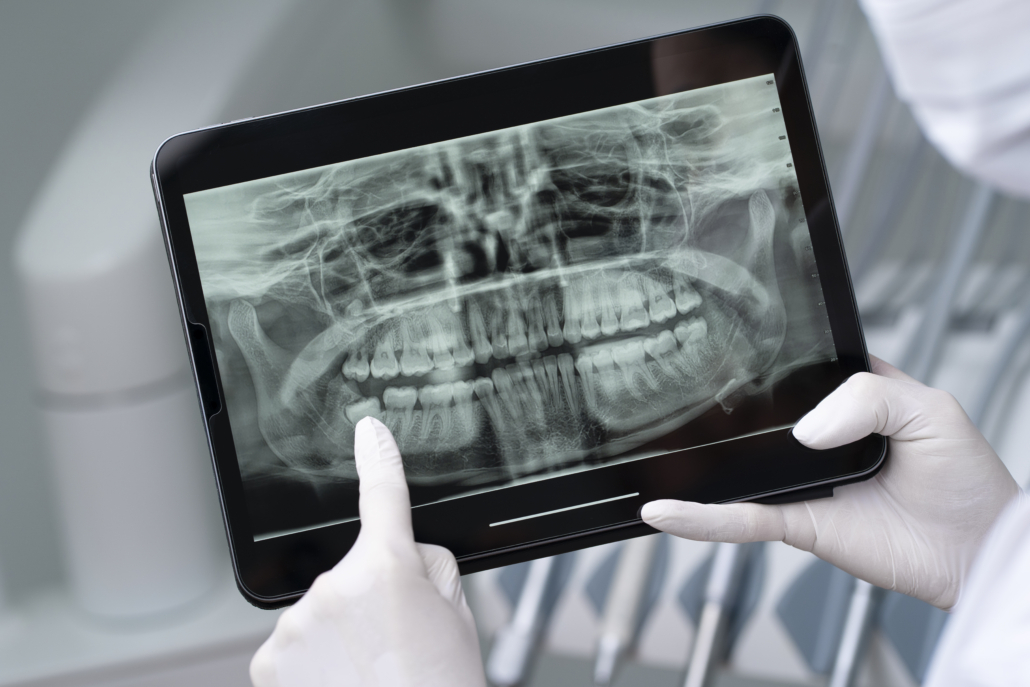 A tablet displaying a dental X-ray image used for modern diagnostics in dental treatment according to European standards.